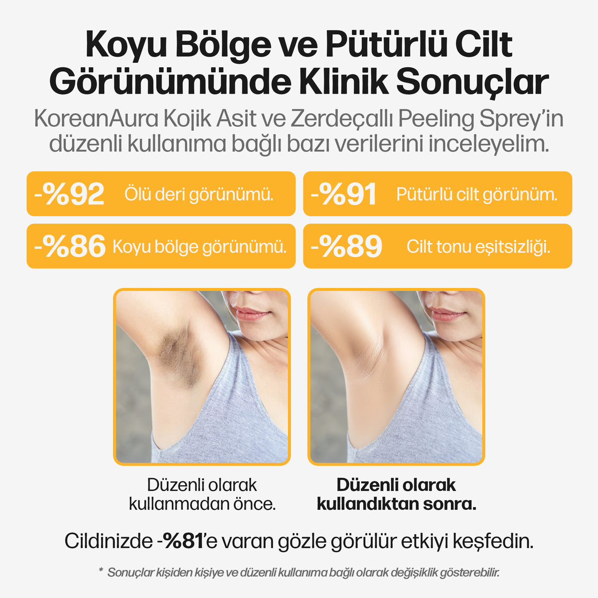 Koreanaura Kojik Asit & Zerdeçal Aydınlatıcı Peeling Vücut Spreyi