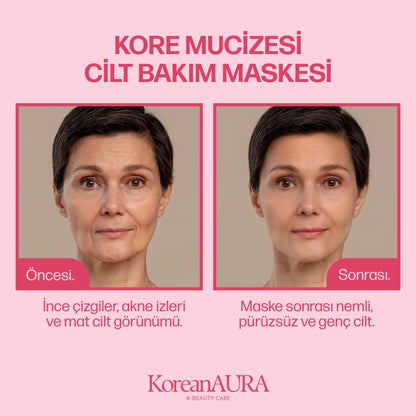 Korean Aura Kırışıklık ve Akne Karşıtı Maske