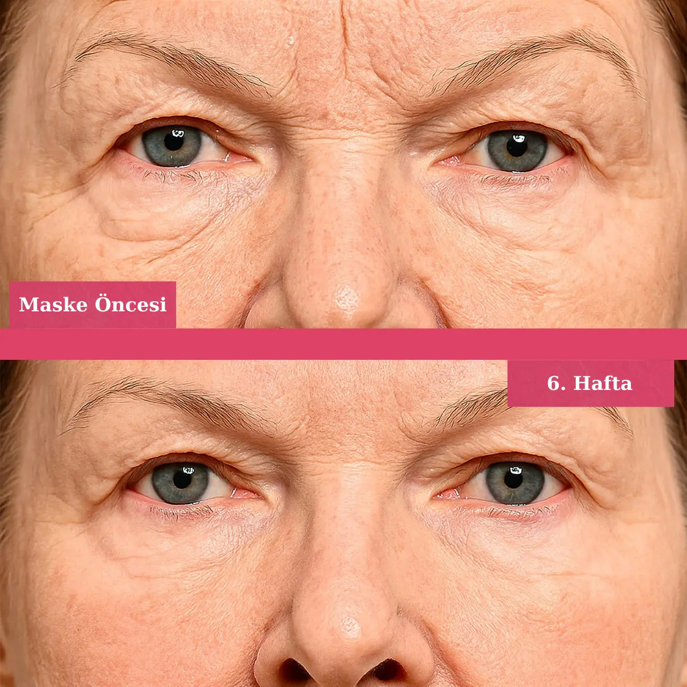 KoreanAura 3D Sıkılaştırıcı Maske