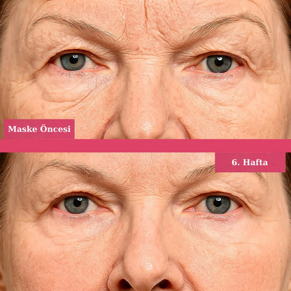 KoreanAura 3D Sıkılaştırıcı Maske