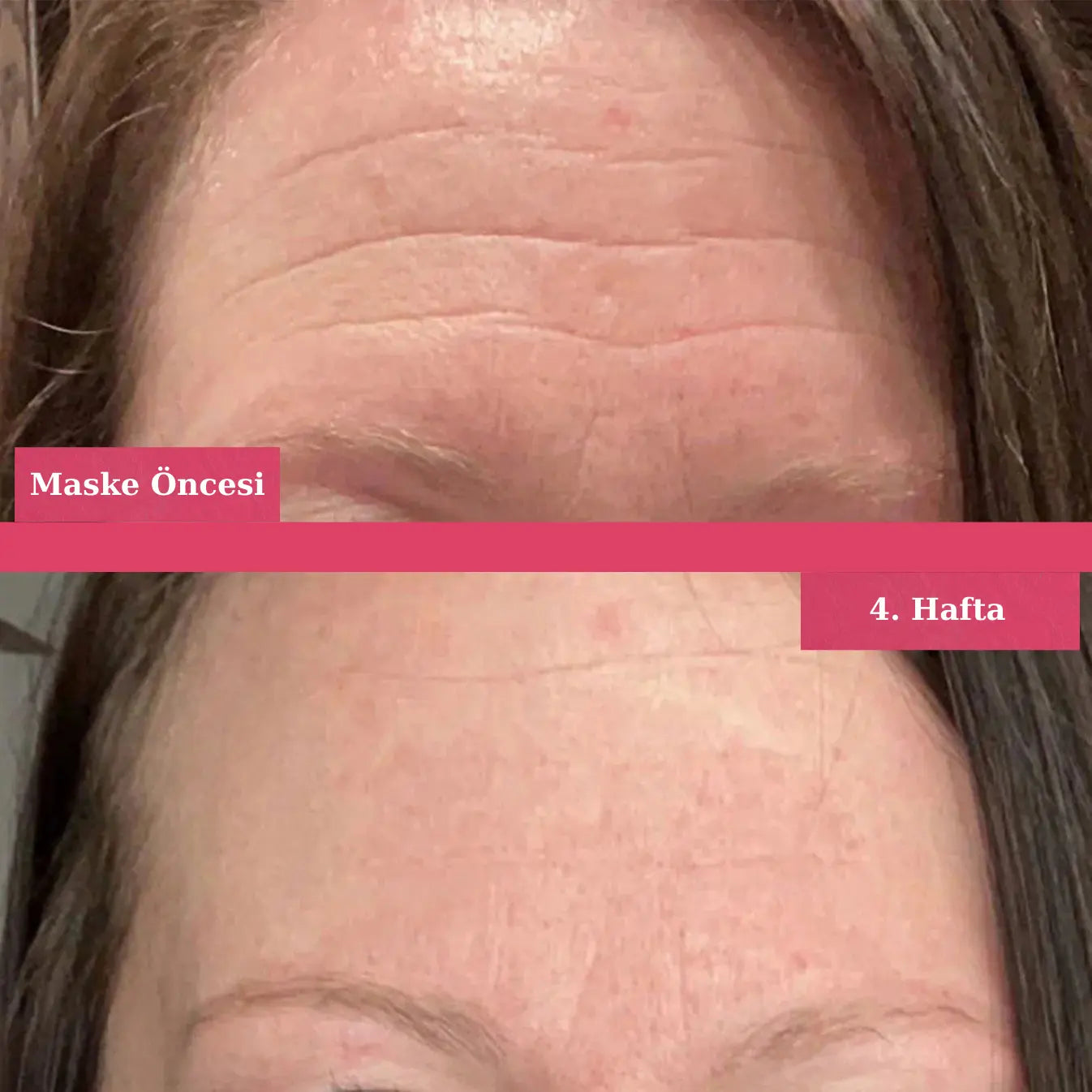 KoreanAura 3D Sıkılaştırıcı Maske