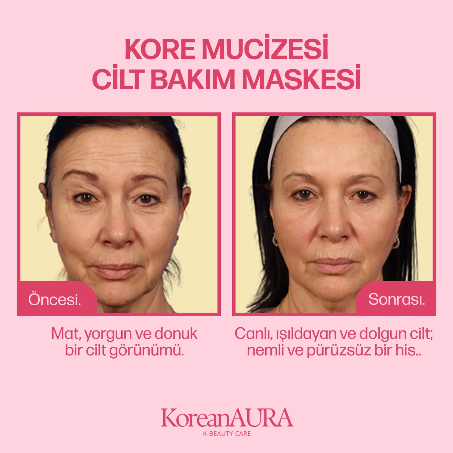 KoreanAura Gold Kapsül Krem