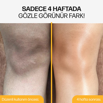 Koreanaura Kojik Asit & Zerdeçal Aydınlatıcı Peeling Vücut Spreyi